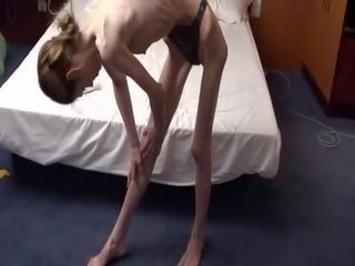 Anorexia